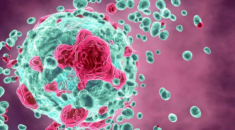 Нова терапија ги убива клетките на ракот без несакани ефекти Gasinet 7362